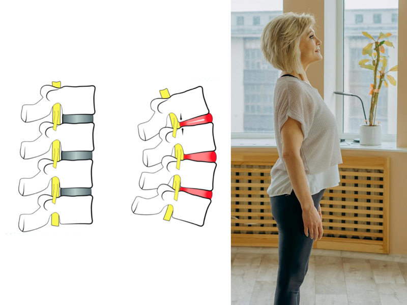 back structure